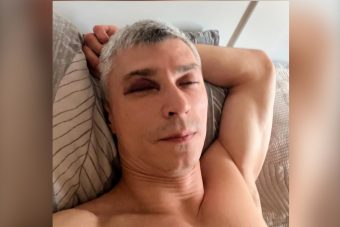 В Твери жестоко избили паралимпийца Антона Федулова
